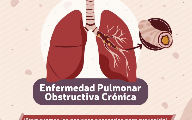 Pulmonar