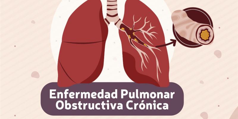 Pulmonar